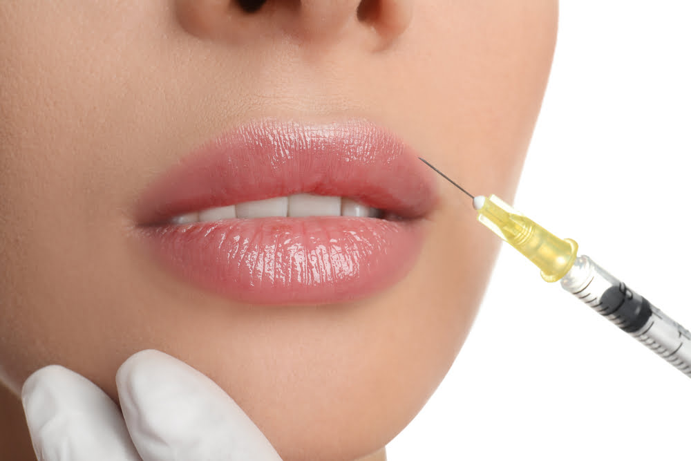 Quanto custa uma aplicação de botox no rosto?