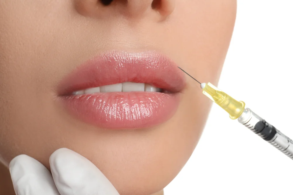 Quanto custa uma aplicação de botox no rosto? 1 Quanto custa uma aplicação de botox no rosto?